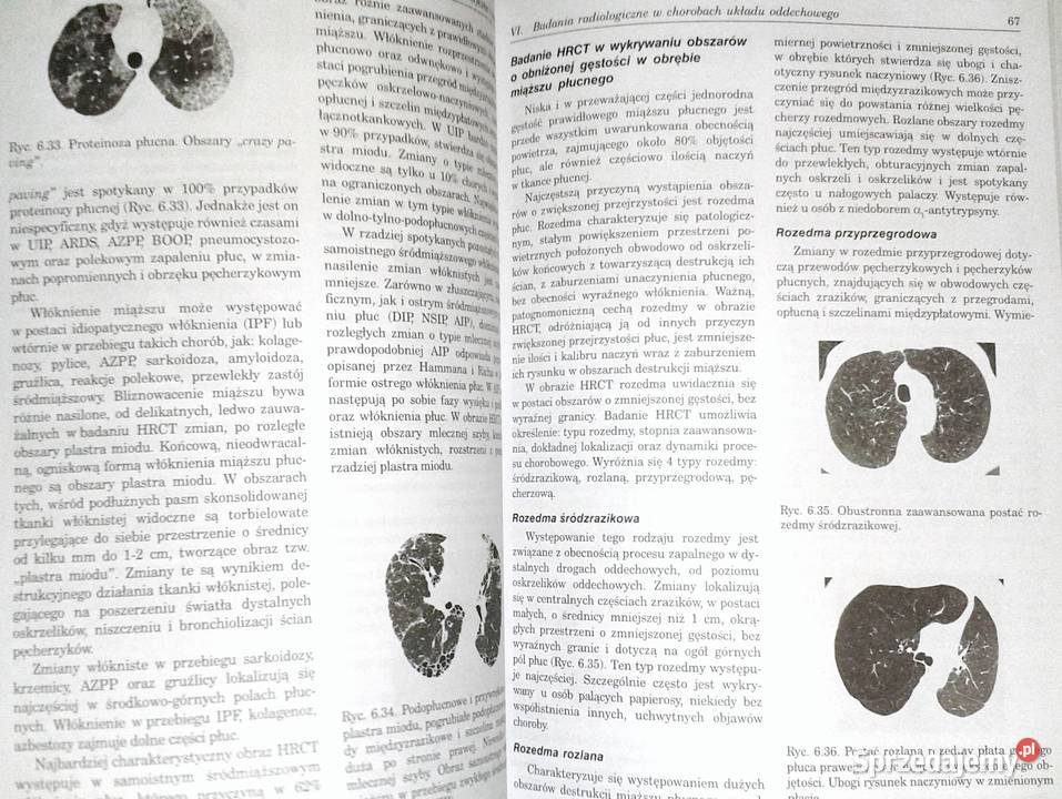 Pneumonologia i alergologia praktyczna Ryszarda Chełm