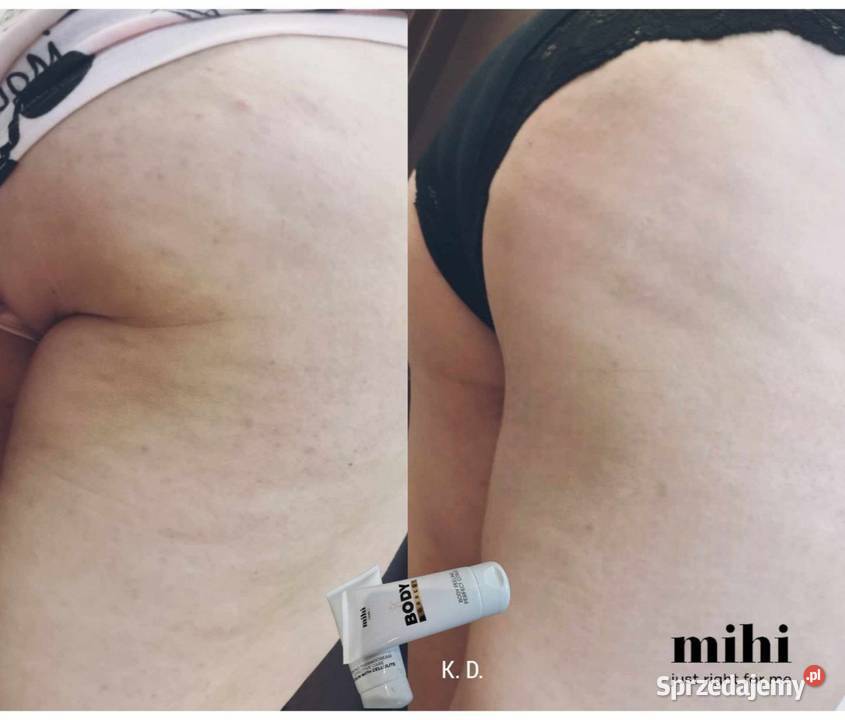 Termokrem ujędrniający Skuteczna pielęgnacja Hajnówka