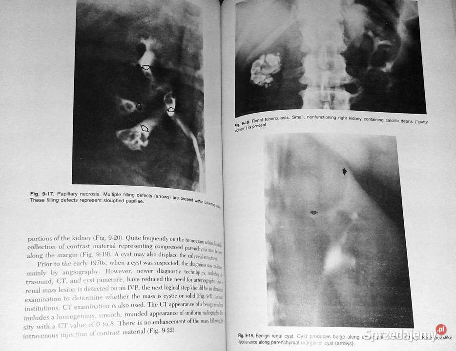 Introduction to Clinical Radiology Richard Pozostałe Chełm