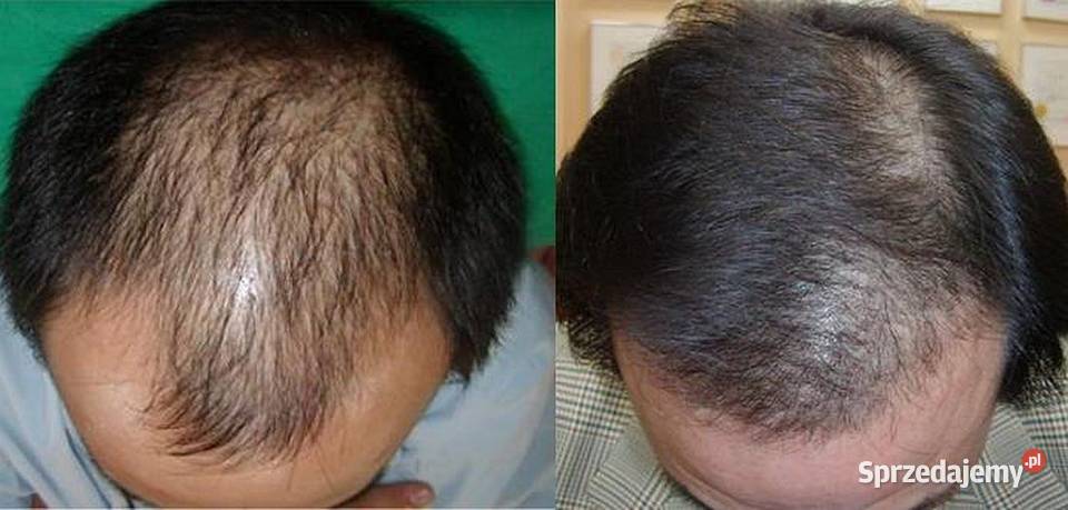 PLAZMA LIGHT lampa plazmowa nowej generacji dolnośląskie Wrocław