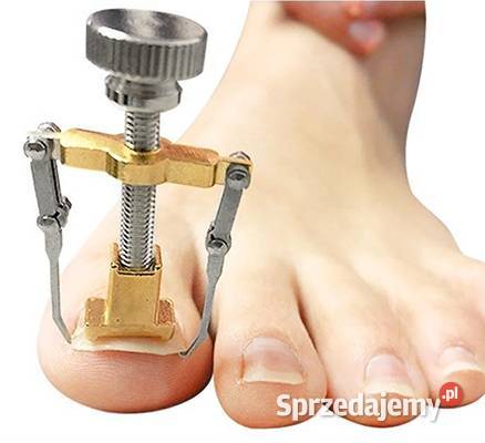 Korekcyjna klamra na wrastające paznokcie Klamra Płock