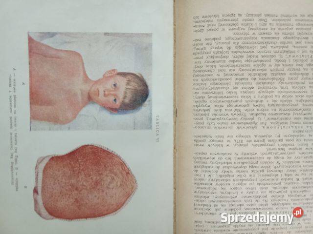 Choroby wewnętrzne SemerauSiemianowski t12 1959 Książki naukowe i popularnonaukowe Łódź