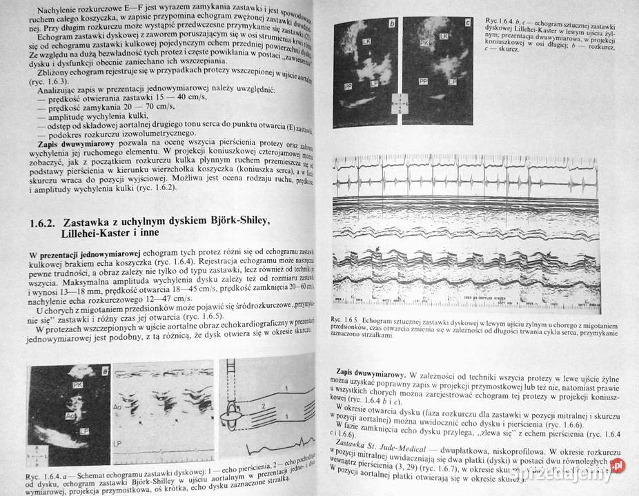 Metody obrazowe w diagnostyce chorób układu miękka Chełm