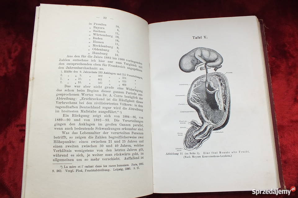 Stara książka Ginekologi Ein dunkler punkt 1907 Antykwariat lubuskie Żary