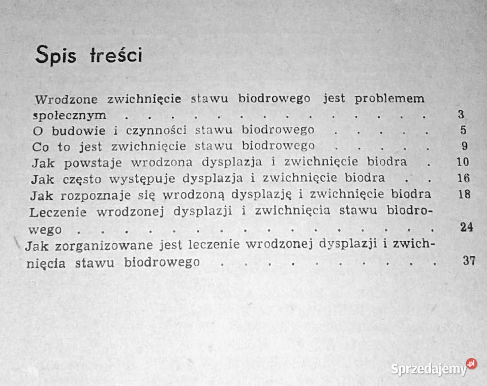 Wrodzone zwichnięcie biodra jest uleczalne Karol Chełm