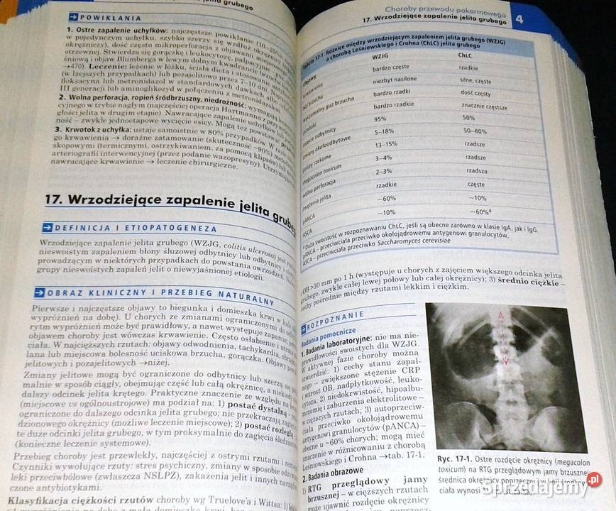 Choroby wewnętrzne Andrzej Szczeklik Piotr Pozostałe