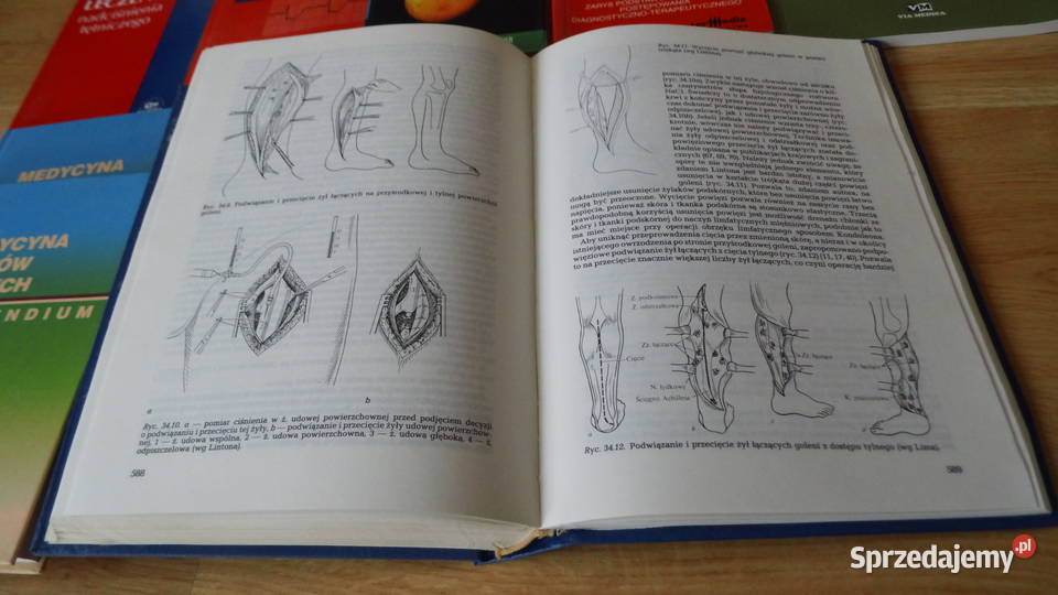 Zdrowie Nadciśnienie Choroby serca Zawał serca Zdrowie i Uroda Radzewice