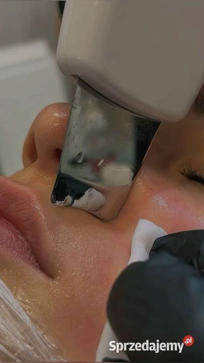 Oczyszczenie wodorowe sekret czystej i Chorzów