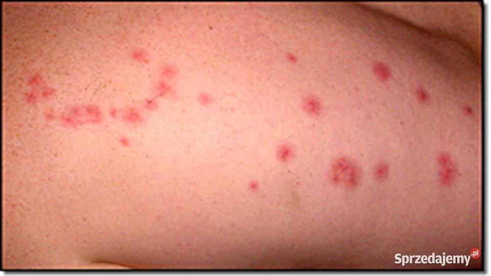 Dezynsekcja Pluskwy Certyfikowany Poziom Wyższy Katowice