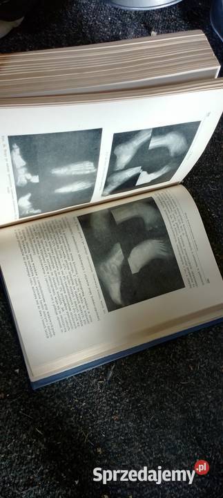 Medyczna książka ortopedyczna PRL Jarosław