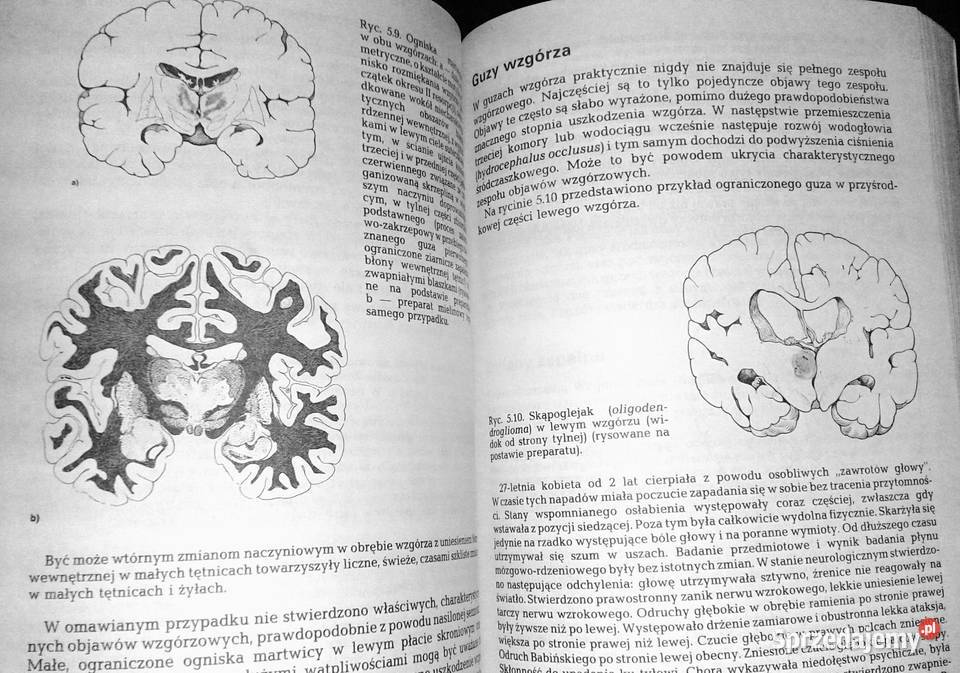 Diagnostyka topograficzna w neurologii Peter lubelskie Chełm