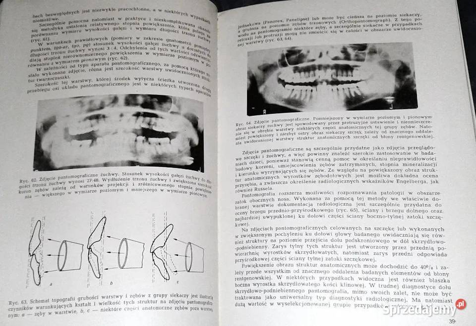 Zarys rentgenodiagnostyki stomatologicznej Z miękka Chełm
