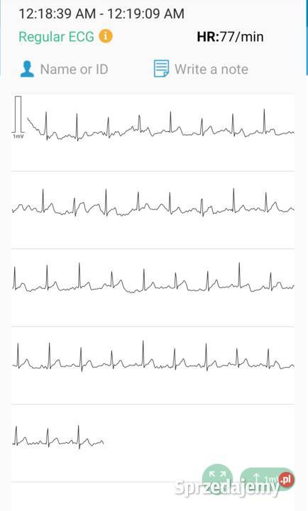 Aparat Monitor EKG Ciśnieniomierz BP2 IOS Myszków sprzedam