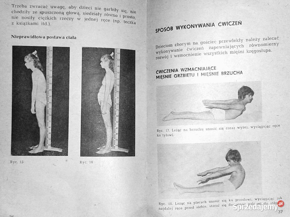 Reumatoidalne zapalenie stawów u dzieci W sprzedam