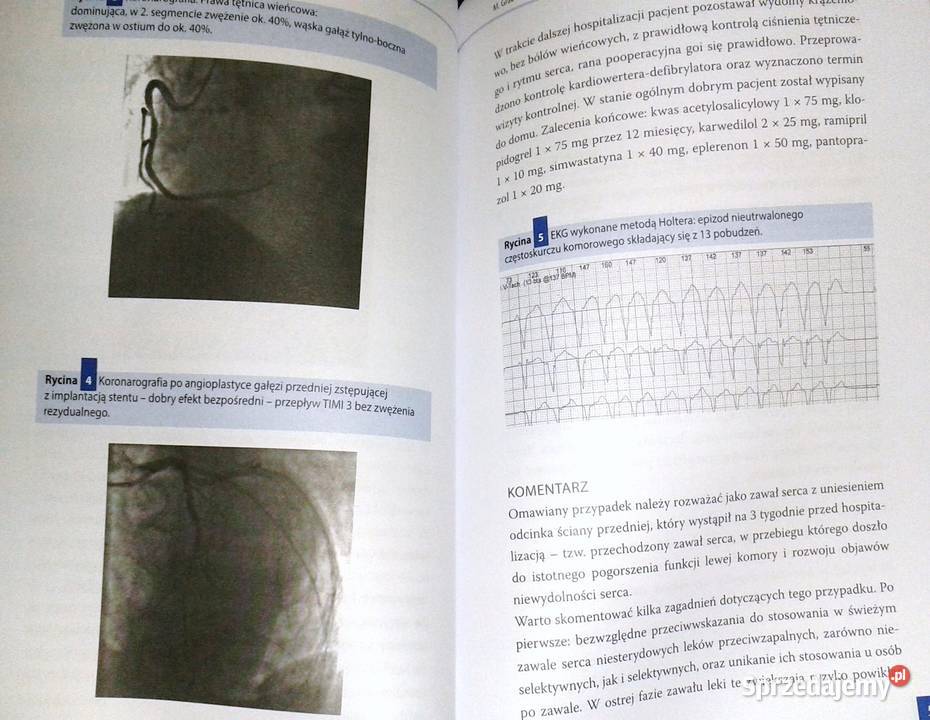 Komentarze do przypadków klinicznych w Chełm sprzedam