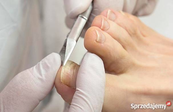 Pedicure leczniczy i pielęgnacyjny z dojazdem do Pielęgnacja, uroda, zdrowie Siemianowice Śląskie