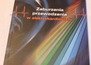 ZABURZENIA PRZEWODZENIA W ELEKTROKARDIOGRAFII