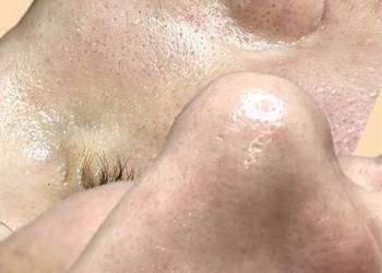 Oczyszczenie wodorowe Świeżość, którą widać od razu