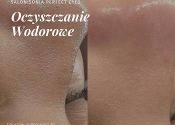 Oczyszczanie Wodorowe