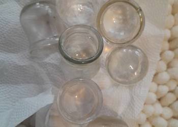 Bańki lekarskie lecznicze