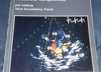 Metody obrazowe w diagnostyce chorób układu krążenia - M. Krzemińska-Pakuła