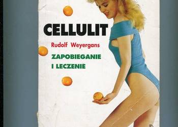 Cellulit Zapobieganie i leczenie - Weyergans