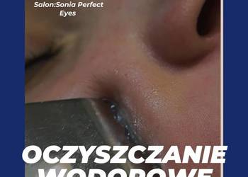 Oczyszczanie wodorowe