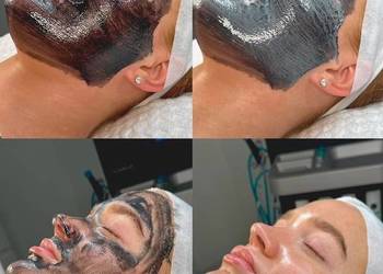 Peeling węglowy – Pożegnaj zaskórniki dzięki peelingowi węglowemu