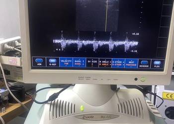 Aparat usg z doplerem kolorowym