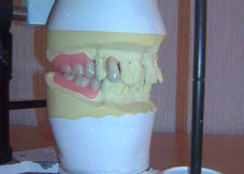 Artykulator dentystyczny protetyczny do montażu protez dentystycznych
