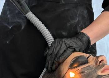 Peeling węglowy – czysta skóra bez filtrów!