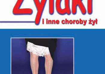 Żylaki i inne choroby żył - Wojciech Noszczyk