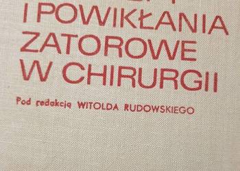Zakrzepy i powikłania zatorowe w chirurgii Witold Rudowski m