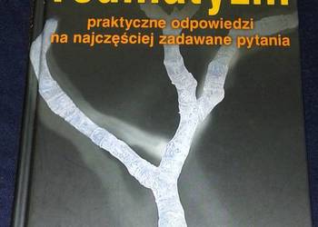 Reumatyzm - Robert G. Lahita