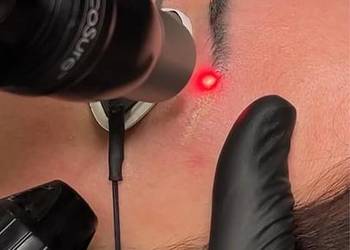 Usuwanie makijażu permanentnego