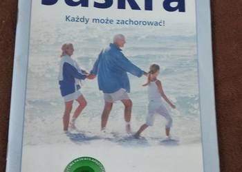 jaskra każdy może zachorować