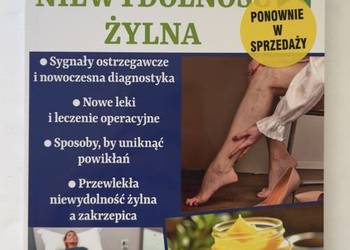 Przewlekła niewydolność żylna poradnik Zadbaj o Zdrowie 01/2025