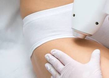 Laserowa depilacja Chorzów