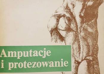 AMPUTACJE I PROTEZOWANIE Vitali Robinson medycyna chirurgia