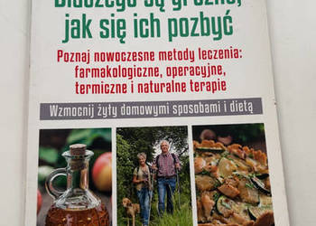 ŻYLAKI Dlaczego są groźne jak się ich pozbyć - Leczenie Terapie Dieta NOWA