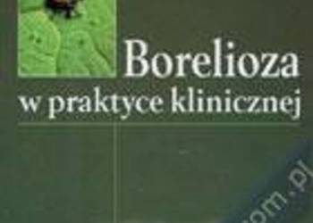 Borelioza w praktyce klinicznej