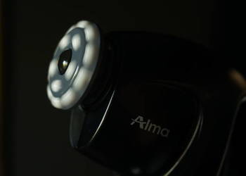 ALMA PRIMEX-ODSTĄPIE LEASING