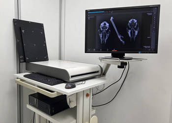 Rentgen przenośny ATOMSCOPE 100 Gierth + skaner cyfrowy rtg FireCR+