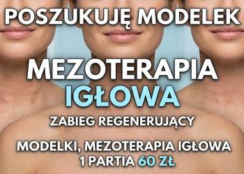 Modelki mezoterapia igłowa