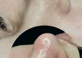 Oczyszczenie wodorowe