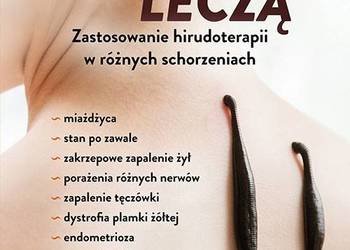 Pijawki leczą. Zastosowanie hirudoterapii w różnych schorzeniach