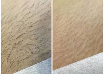 Depilacja cukrowa Słodycz dla skóry, nie dla włosków