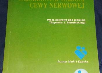 Zapobieganie wrodzonym wadom cewy nerwowej - Z. Brzeziński