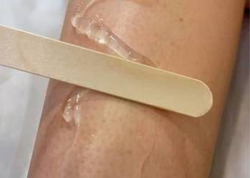 Laserowa Depilacja ciała