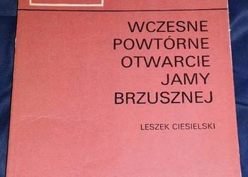 Wczesne powtórne otwarcie jamy brzusznej - Leszek Ciesielski